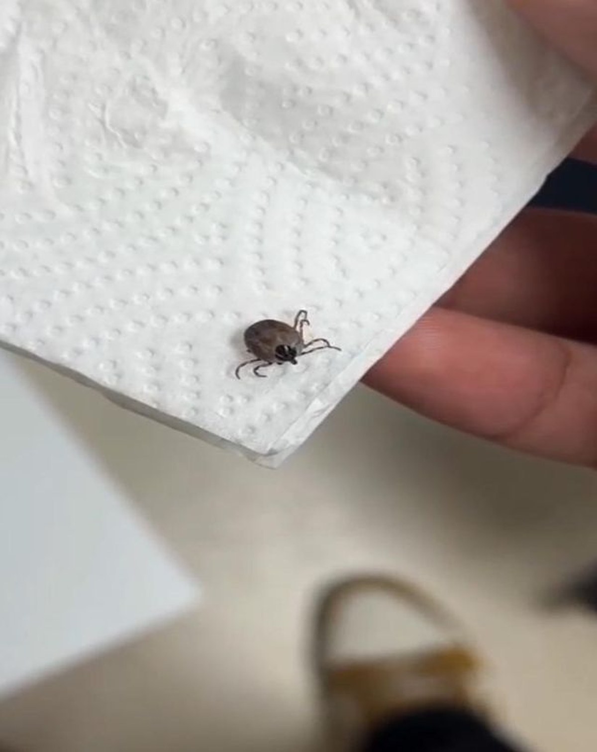 Kulak Ağrısının Şaşırtıcı Sebebi: 5 Yaşındaki Çocuğun Kulağından Canlı Kene Çıkarıldı!