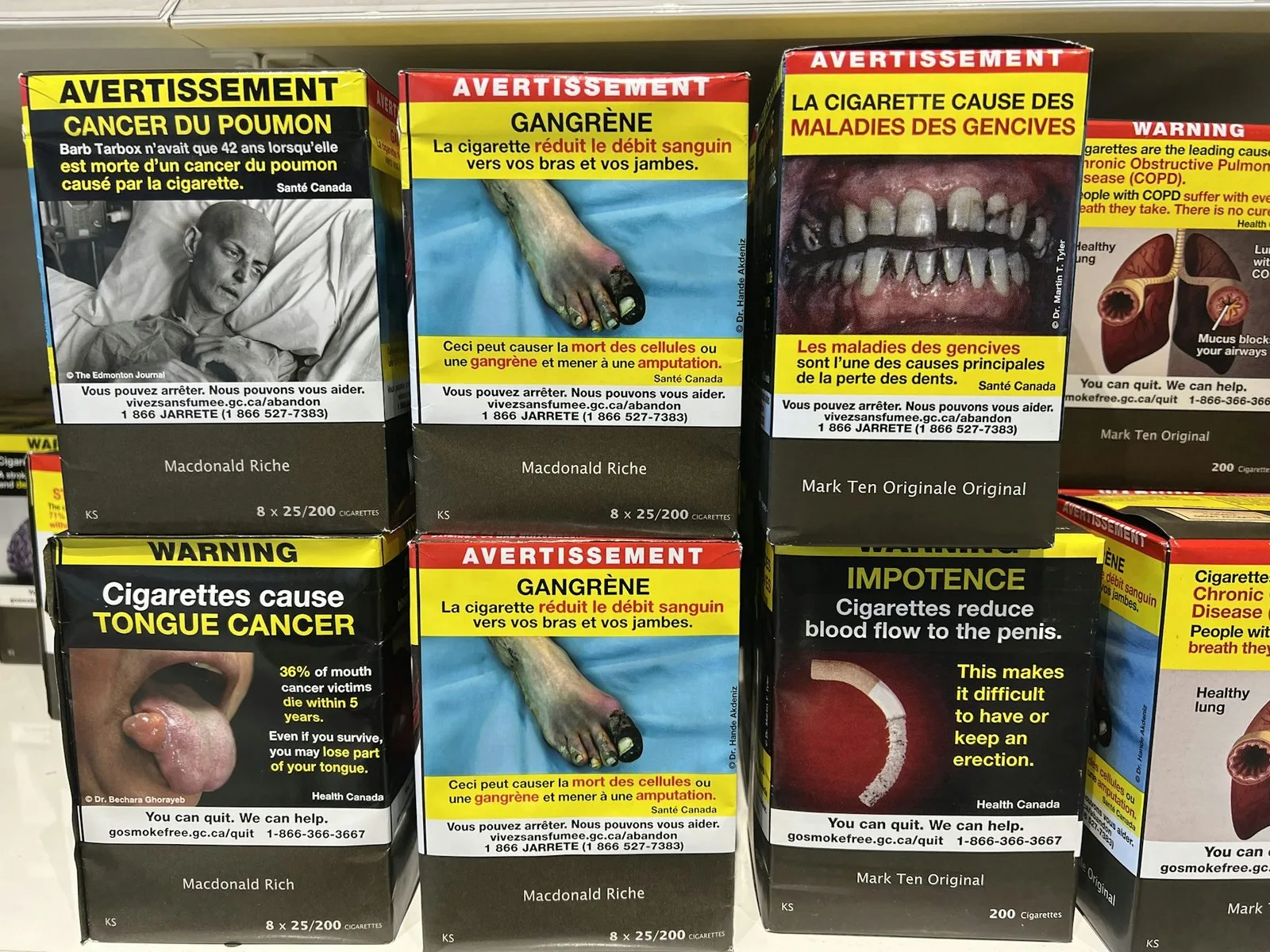 Gruesome warnings on tobacco products can spark fear – but what’s the next step? Creative Touch Imaging Ltd./NurPhoto via Getty Images