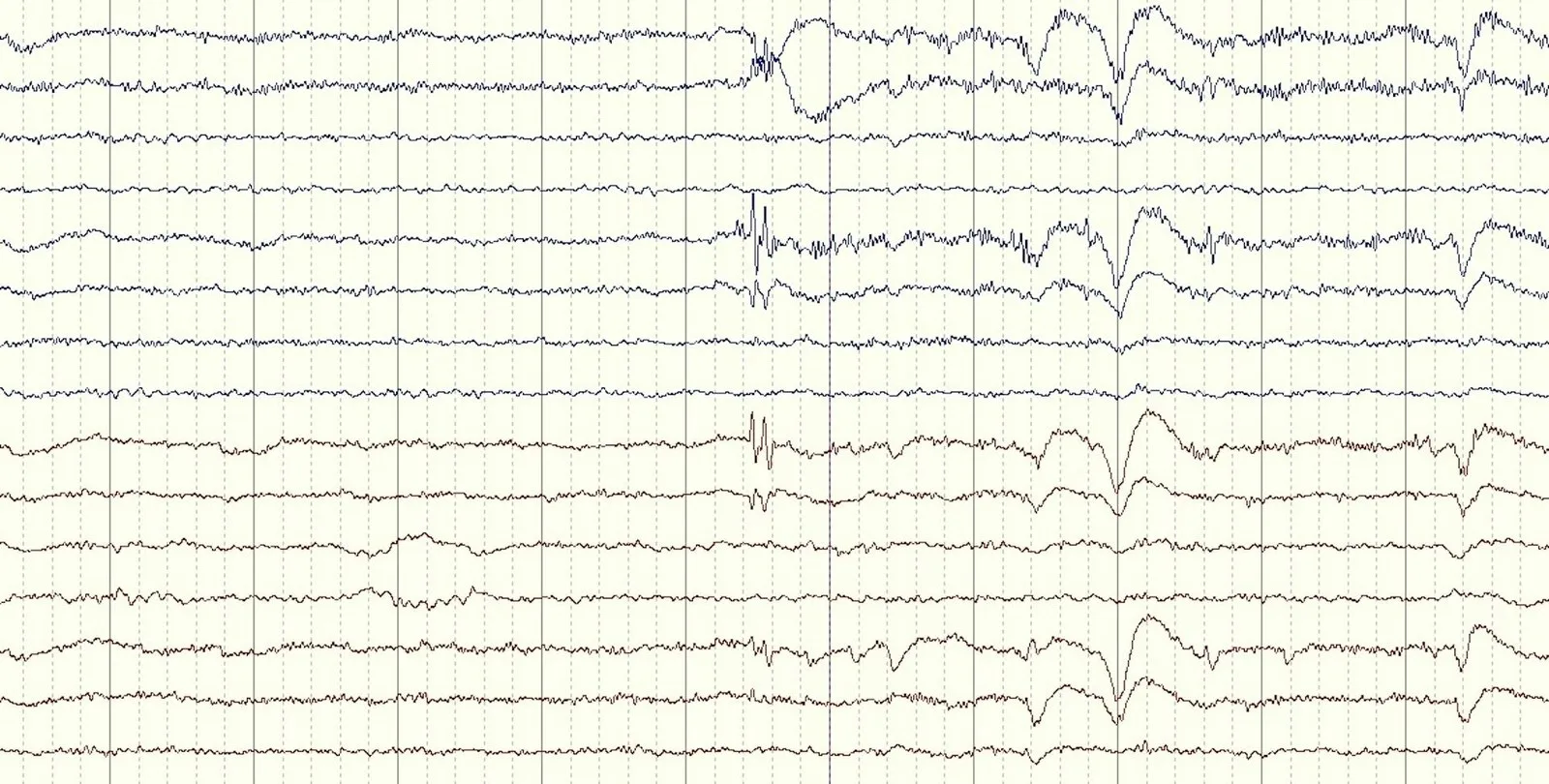 Human brain signals are complex, can be difficult to read and are highly individual. Otoomuch/Wikimedia Commons, CC BY-SA
